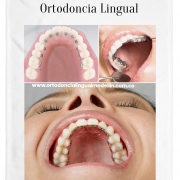 Dr. Jorge Echeverri, ortodoncia sin braquets